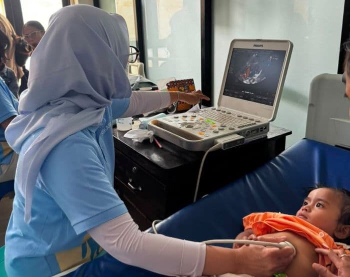 idai_periksa_gratis_300_anak_untuk_deteksi_dini_penyakit_jantung_bawaan