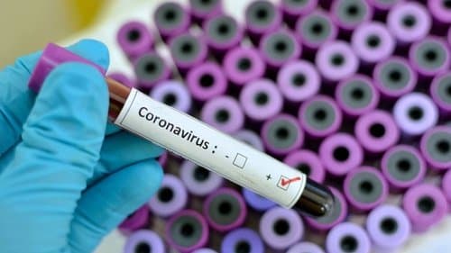 ajudan_wakil_gubsu_sembuh_dari_positif_covid_19