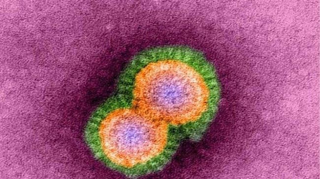 china_laporkan_kasus_pertama_penularan_virus_flu_burung_langka_h10n3