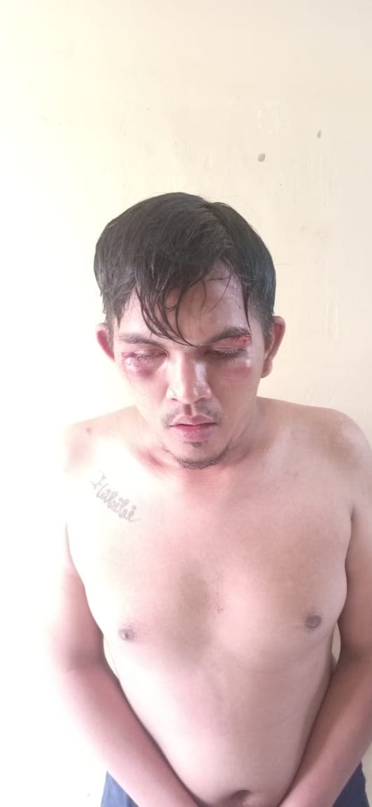 menjambret_jukir_nyaris_dibakar_massa_di_medan_area