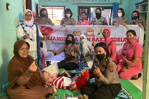 penderita_hidrosefalus_di_siantar_terima_bantuan_polwan