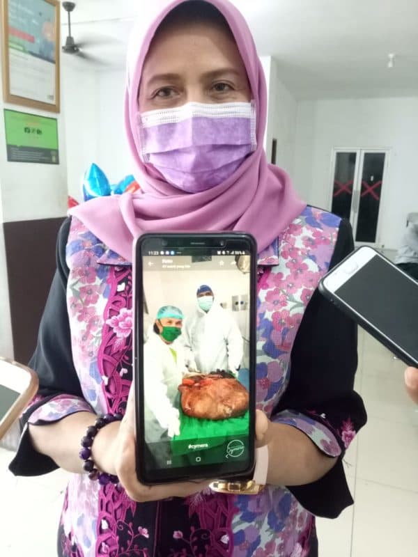 tumor_sekitar_30_kg_berhasil_dioperasi_dari_dada_andrian_putra_di_medan
